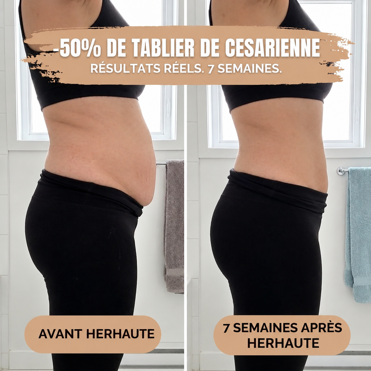 Culotte Post-Partum - Compression 360°